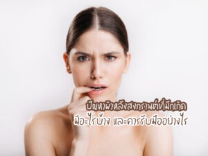 ปัญหาผิวหลังสงกรานต์ที่มักเกิด มีอะไรบ้าง และควรรับมืออย่างไร