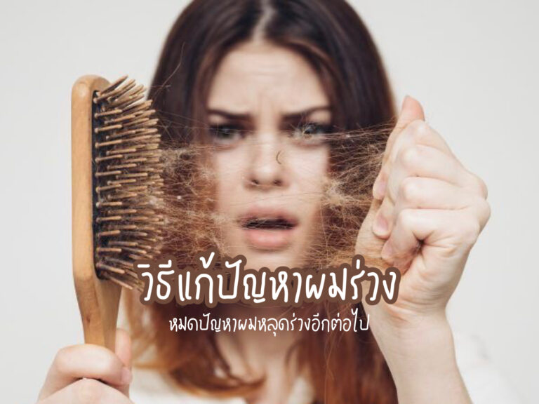 วิธีแก้ปัญหาผมร่วง