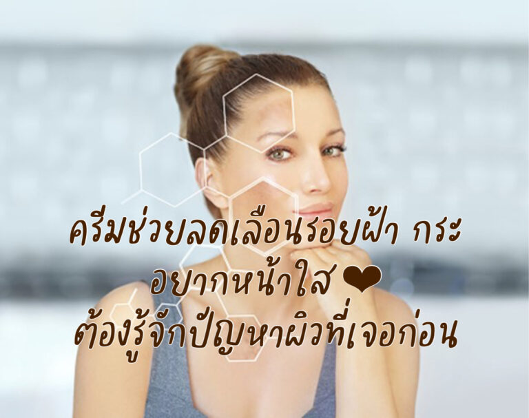 ครีมช่วยลดเลือนรอยฝ้า กระ