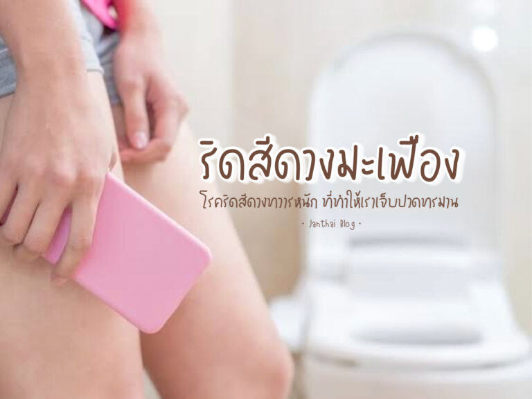 ริดสีดวงมะเฟือง