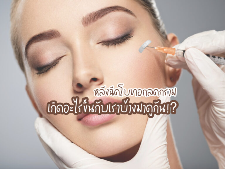 โบทอกลดกราม