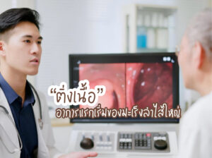 “ติ่งเนื้อ” อาการแรกเริ่มของมะเร็งลำไส้ใหญ่