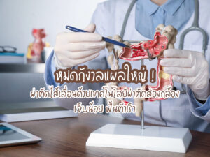 หมดกังวลแผลใหญ่ ! ผ่าตัดไส้เลื่อนด้วยเทคโนโลยีผ่าตัดส่องกล้อง เจ็บน้อย ฟื้นตัวเร็ว