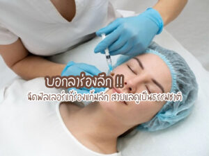 บอกลาร่องลึก! ฉีดฟิลเลอร์แก้ร่องแก้มลึก สวยแลดูเป็นธรรมชาติ