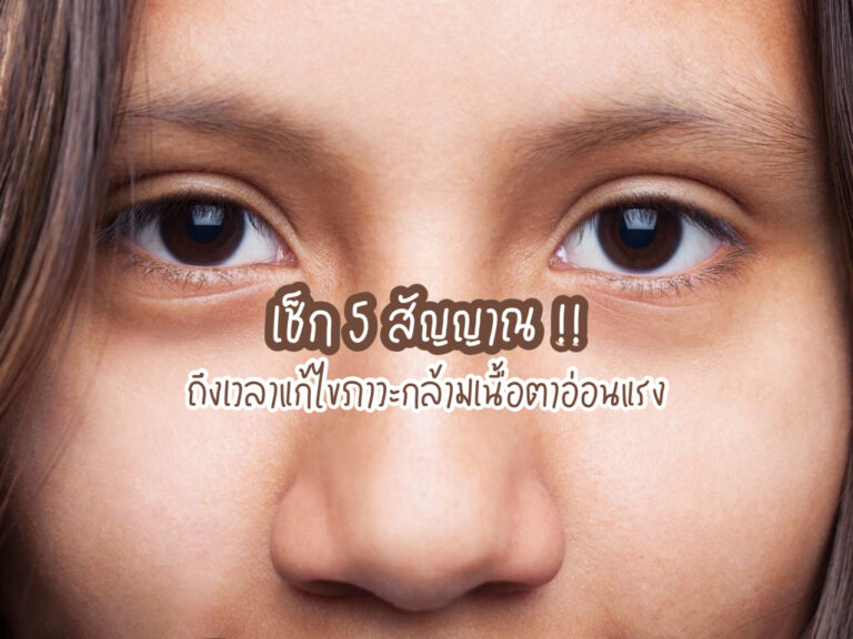 ภาวะกล้ามเนื้อตาอ่อนแรง